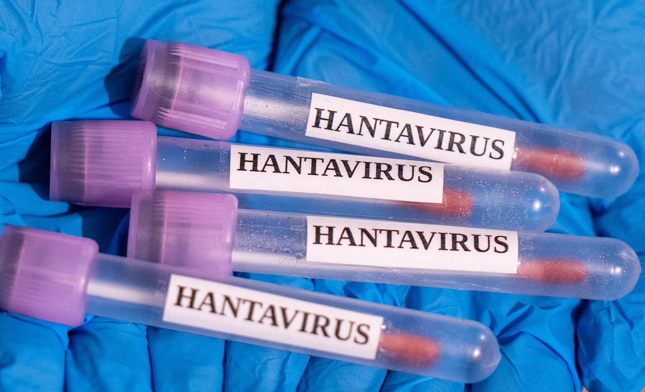 Why the Hantavirus Cruise Ship Outbreak Isn’t Likely to Become a Global Crisis